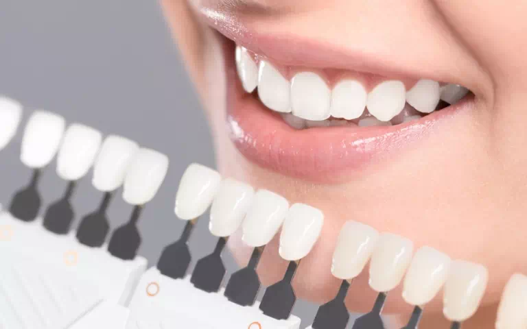 sprawdzanie odcienia zębów