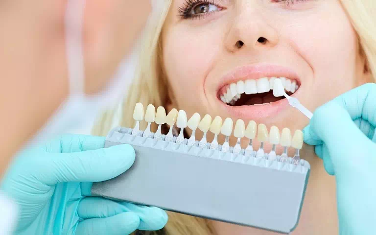 dobieranie odcienia zębów